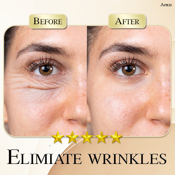 Aexzr™ Anti-wrinkles Moisturizing Eye Cream