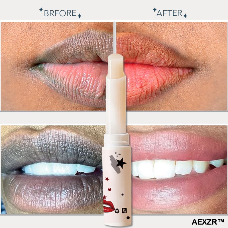 AEXZR™ Lip Balm for Dark Lips